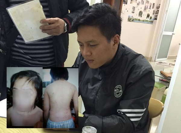 Chủ tịch Nguyễn Đức Chung chỉ đạo sớm kết luận vụ bé trai 10 tuổi bị bố đẻ bạo hành