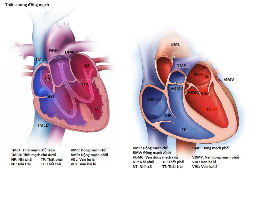 Thêm một em bé bị bệnh tim phức tạp được ‘tái sinh’ bằng kỹ thuật mổ tim không đau.