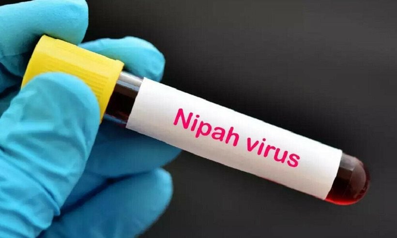 virus-nipah-6818.jpg