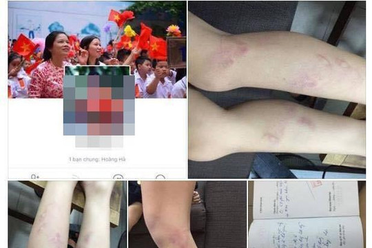 Chủ tịch Hà Nội yêu cầu xử lý vụ 11 học sinh lớp hai bị giáo viên bạo hành