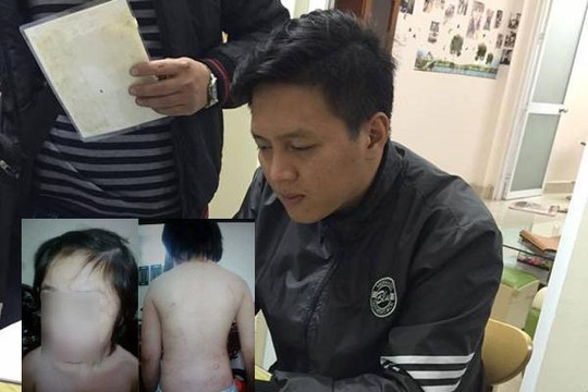 Chủ tịch Nguyễn Đức Chung chỉ đạo sớm kết luận vụ bé trai 10 tuổi bị bố đẻ bạo hành