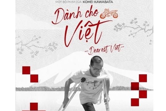Phim tài liệu về cặp song sinh tách dính Việt - Đức chính thức ra rạp Việt Nam