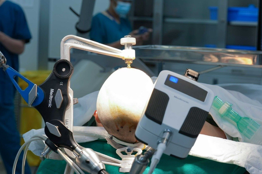 Vinmec Central Park mở lối đi mới trong điều trị động kinh bằng công nghệ Robot đỉnh cao