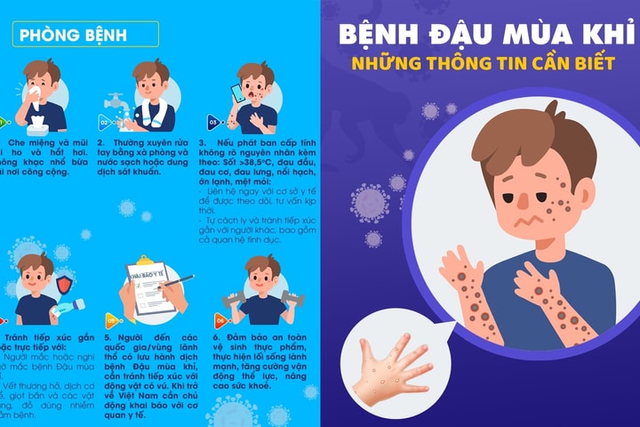 Thành phố Hà Nội tăng cường phòng, chống bệnh Đậu mùa khỉ