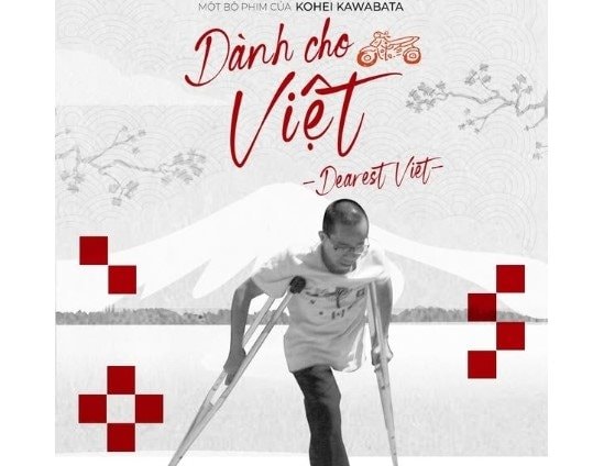 Phim tài liệu về cặp song sinh tách dính Việt - Đức chính thức ra rạp Việt Nam